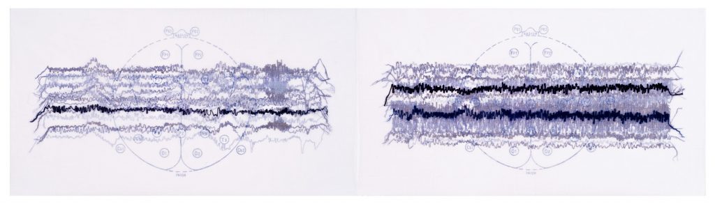 © Gail Biederman 2007, "Myoclonic/Tonic Clonic," diptych, collagraph, collage, screenprint and stitching on paper and fabric, 11.5" x 24" image, 15" x 28" sheet. Price: $1,500